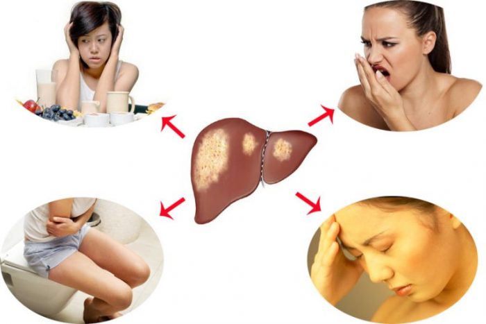 Cơ quan giải độc cơ thể